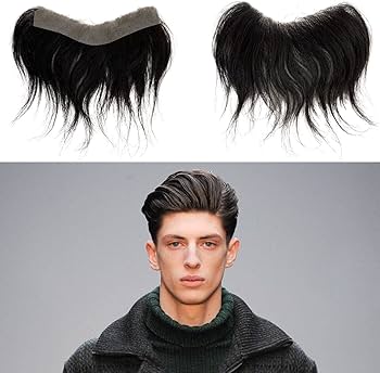 front hairline topper