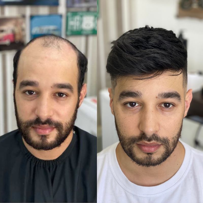 clip in hair extensions before and after
