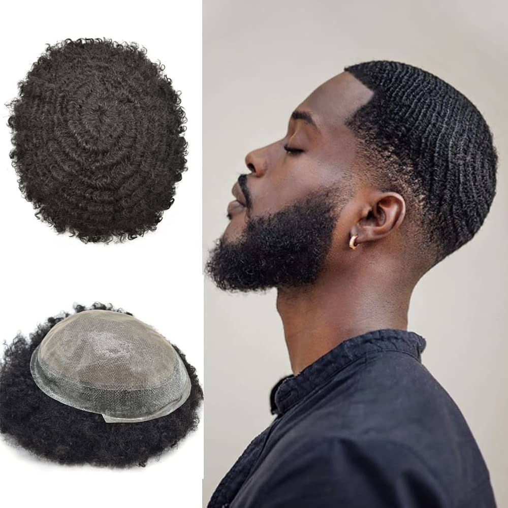 black male hair replacement