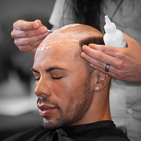hair replacement in pittsburgh