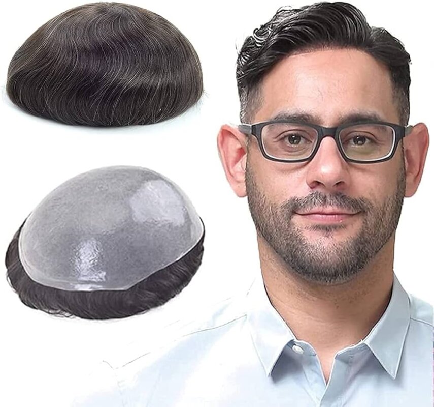 lordhair systems HairNotion