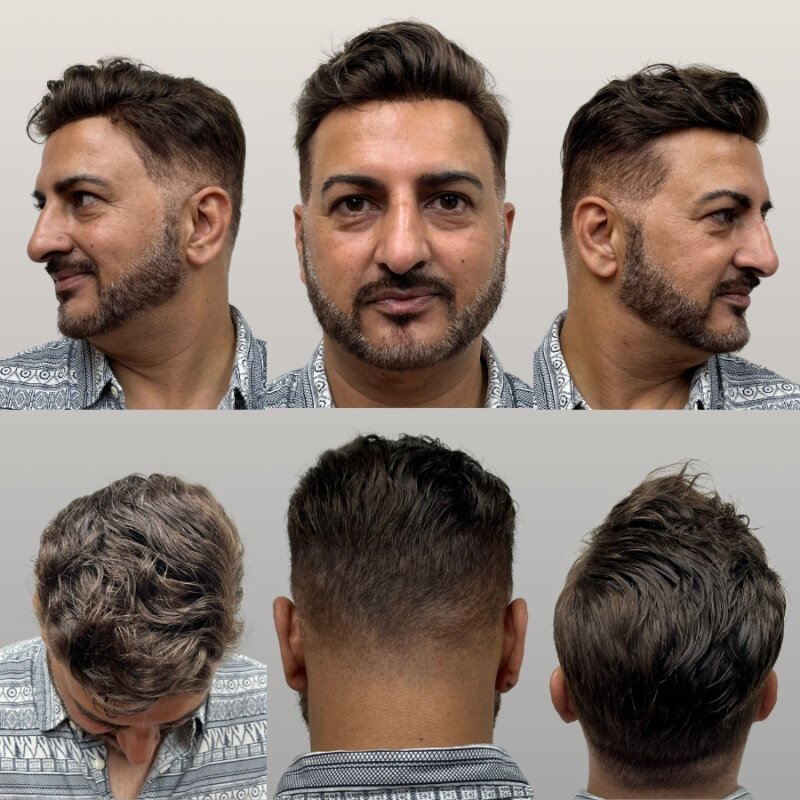 jernigan's hair replacement HairNotion