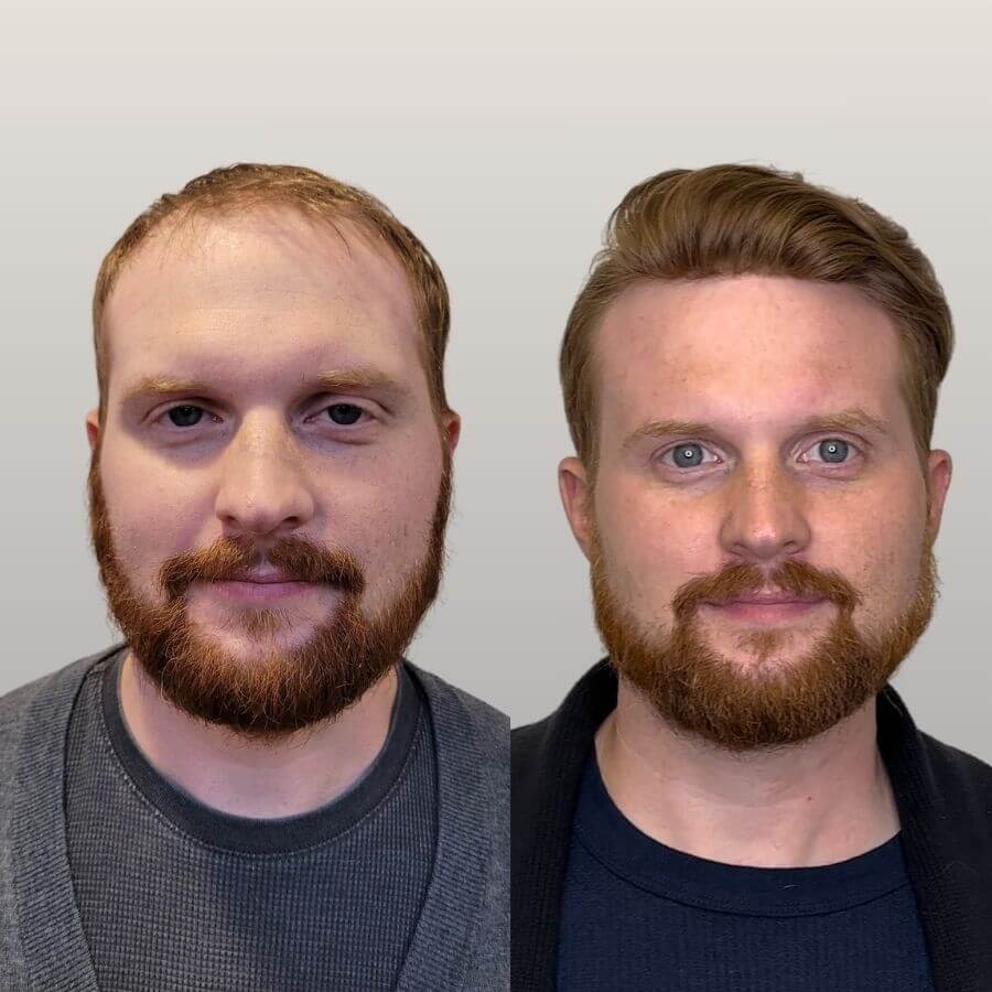 jernigan's hair replacement