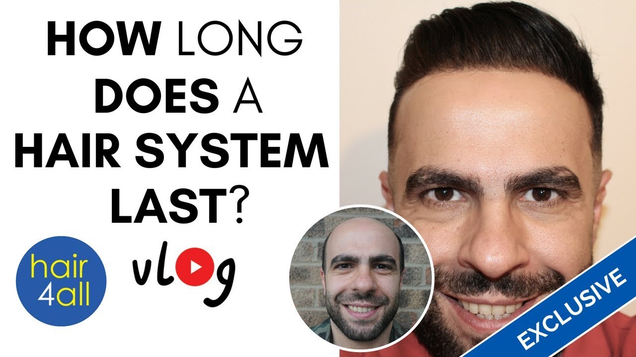 how long does a hair system last