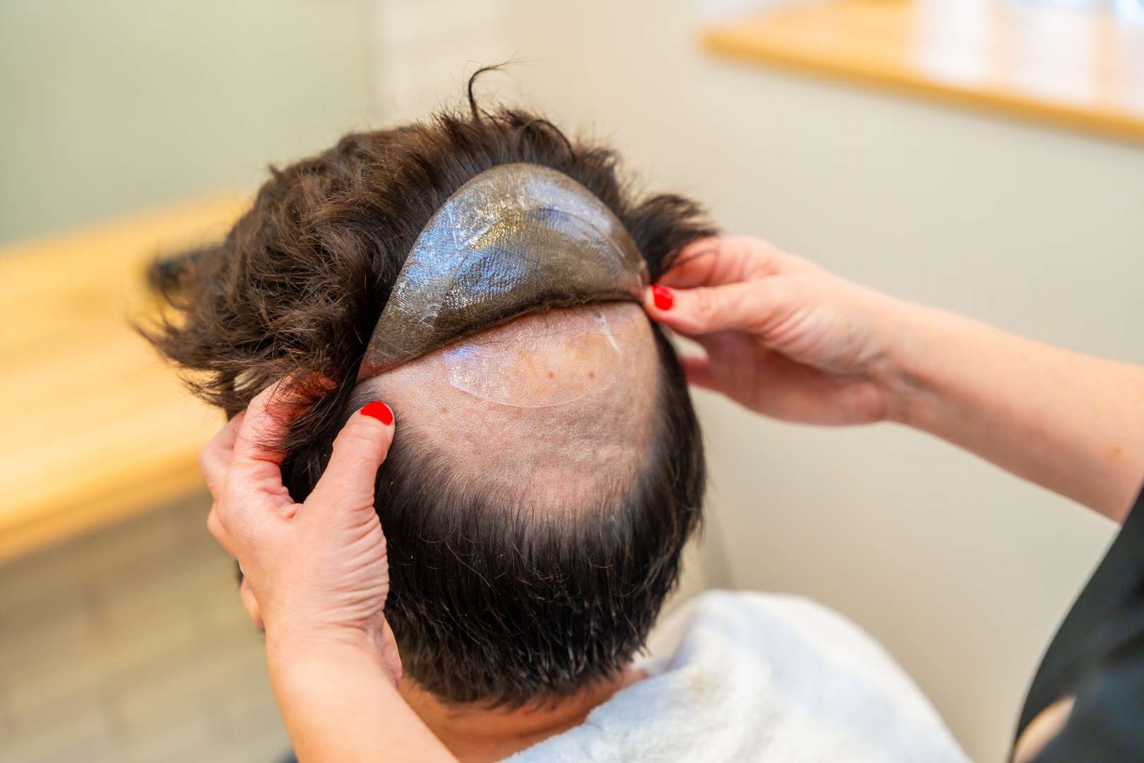 hair replacement cincinnati ohio
