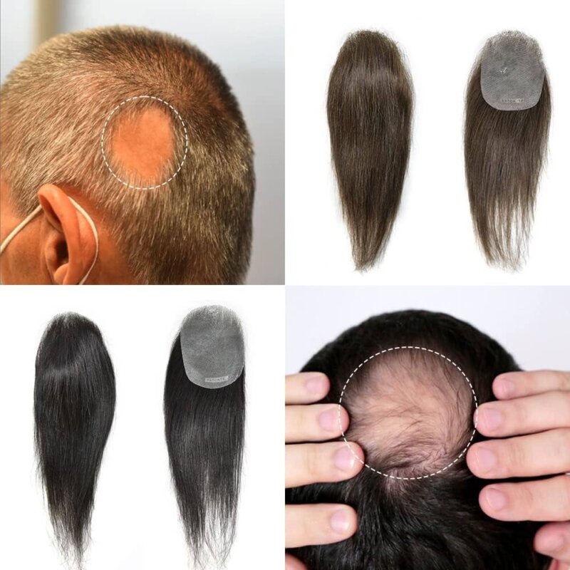 hair patches for bald spots HairNotion