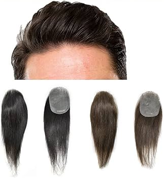 hair patches for bald spots