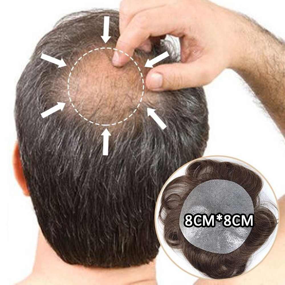 hair patches for bald spots