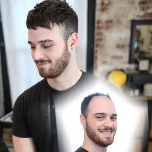 hairnotion hair systems style