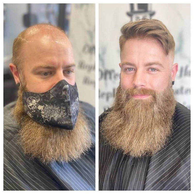 non-surgical hair replacement style