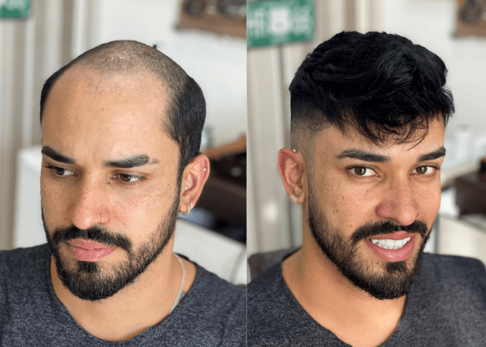 partial hair systems style