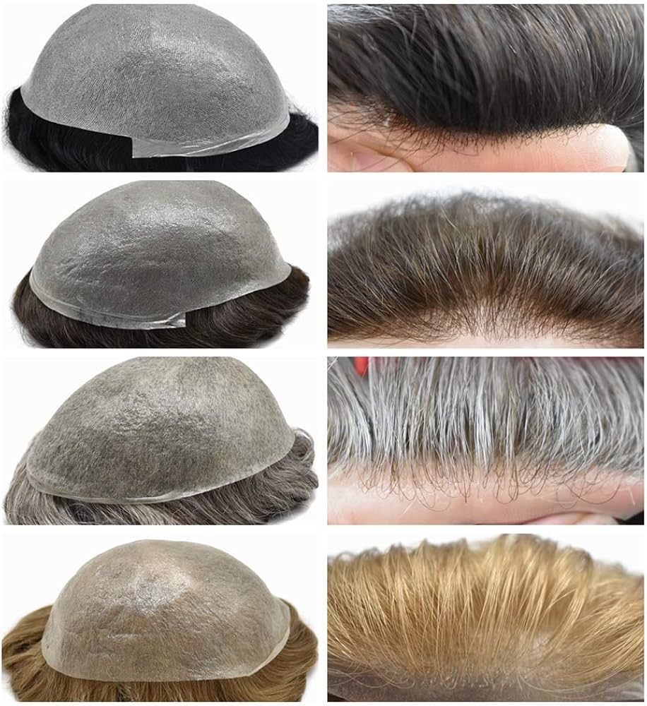 thin skin hair system style