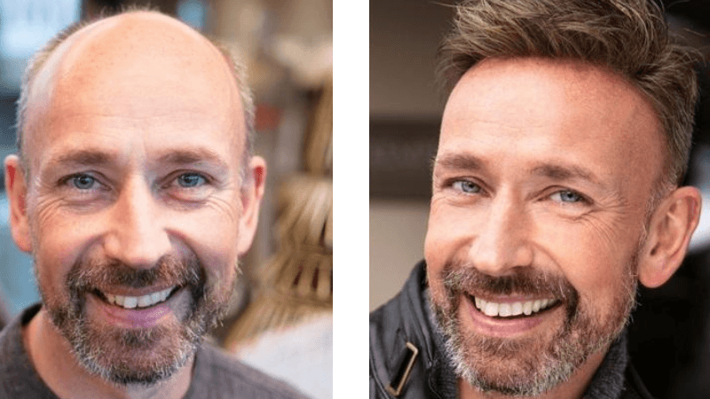 HairNotion Toupee before and after