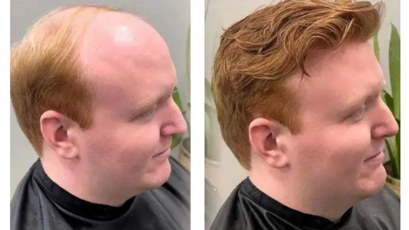 hairnotion toupee for men