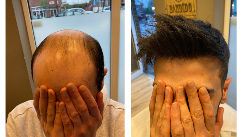 men hair system before and after