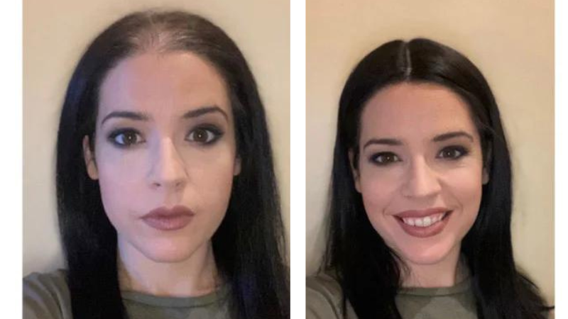 wear women wig before and after
